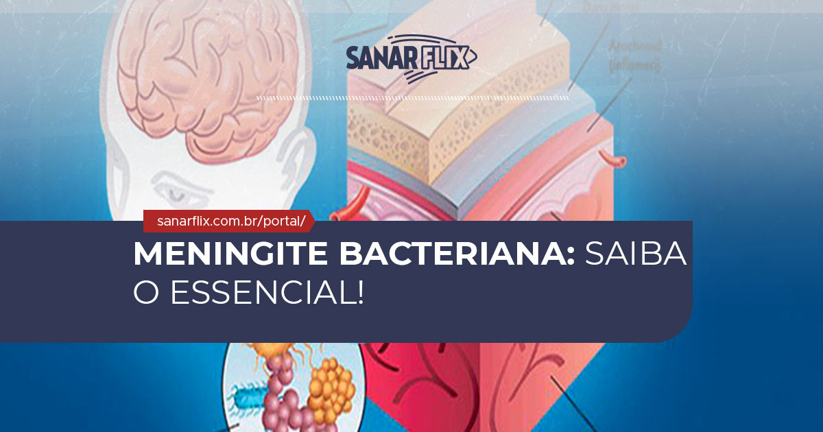 Meningite bacteriana, Meningite bacteriana: saiba o essencial!